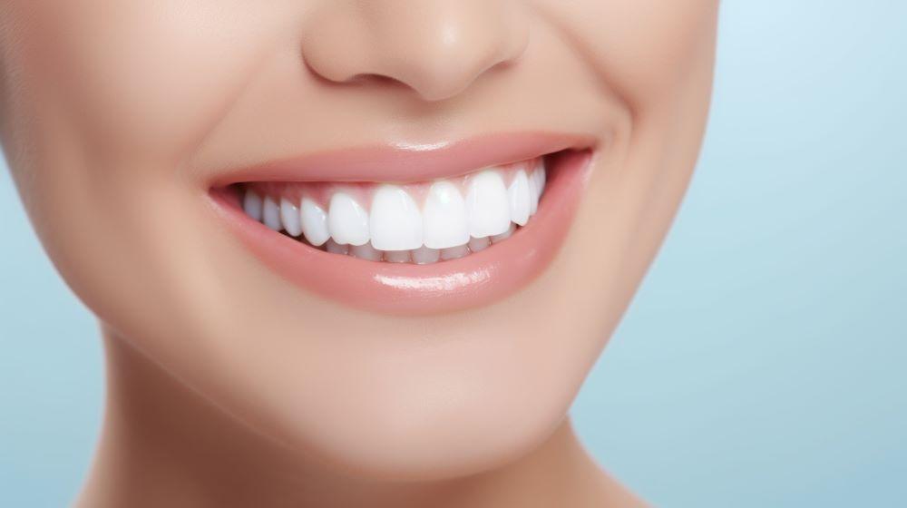 Kronen oder Veneers