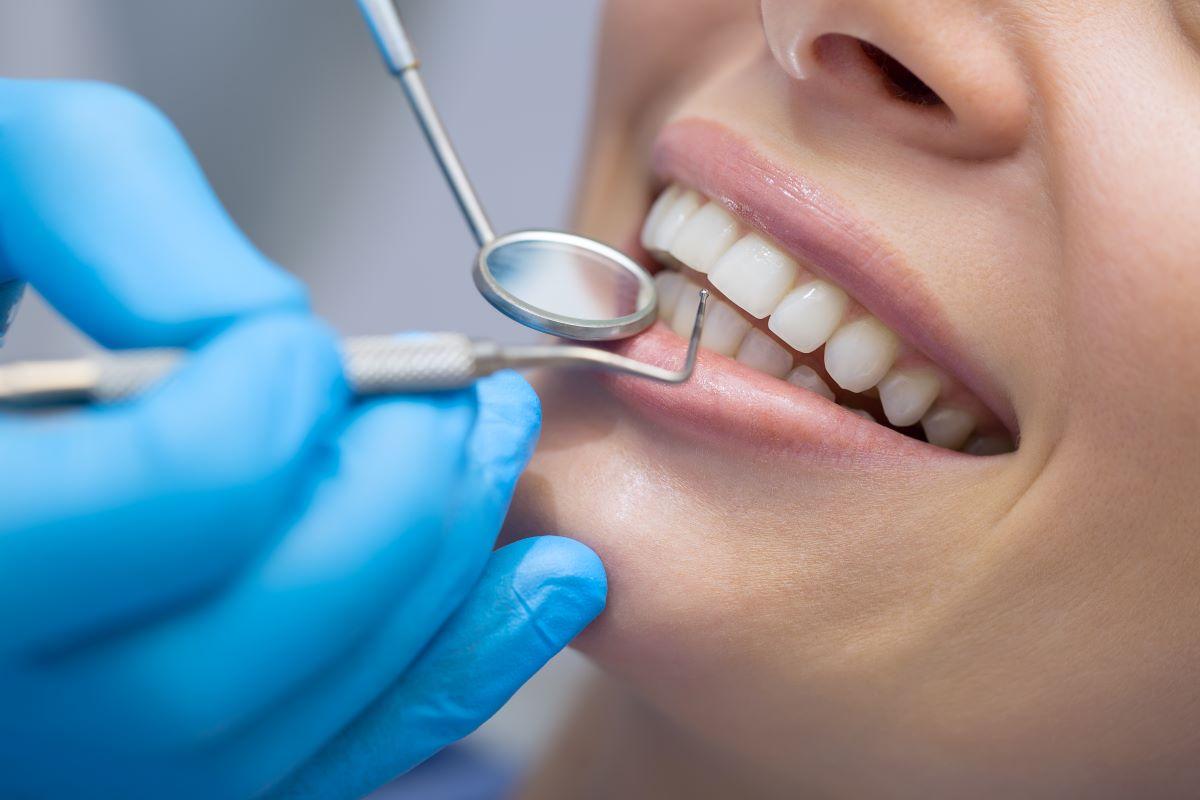 Wann sind Veneers medizinisch notwendig